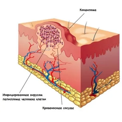 Extempore — Extempore