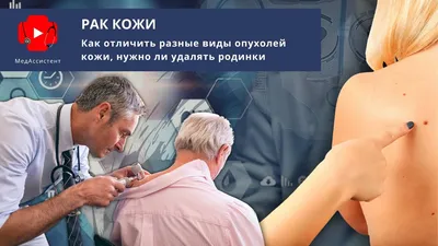 Новообразования кожи | Diapositivas Дерматовенерология | Docsity