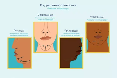 Фимоз у детей - причины, симптомы и методы лечения в клинике Фэнтези