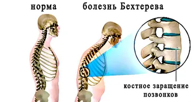 36 типов крыш для домов (стили и дизайны)| СК «ГЛУШАКОВ»