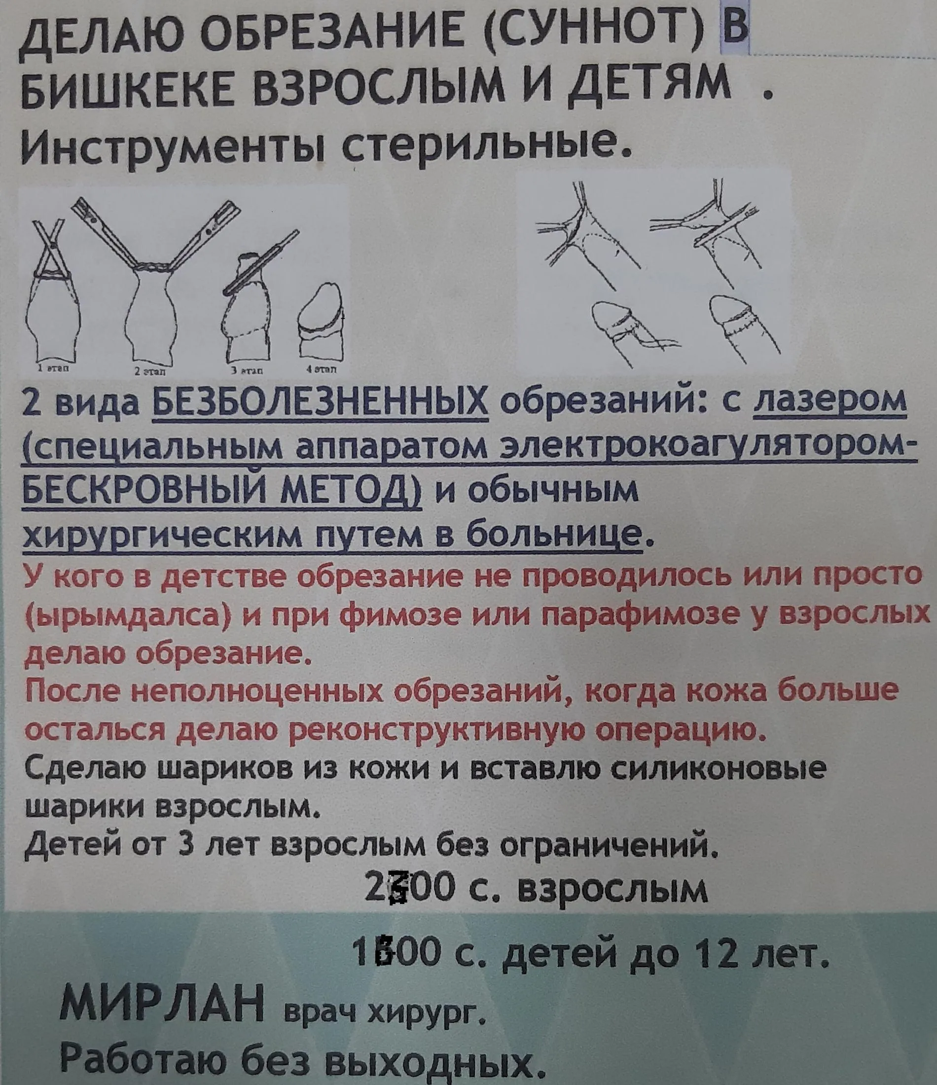 Обрезание в москве отзывы