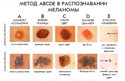 ГБУЗ МО \"Сергиево-Посадская больница\"