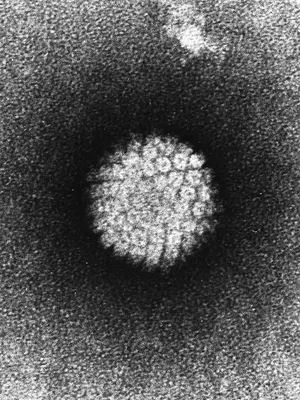 Вирус папилломы человека: что значит ВПЧ, типы HPV у мужчин и женщин |  Аллокин-Альфа