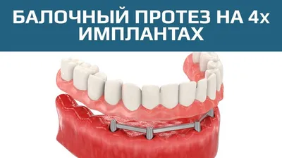 Протезирование зубов в Киеве - Клиника эстетической стоматологии E-stom