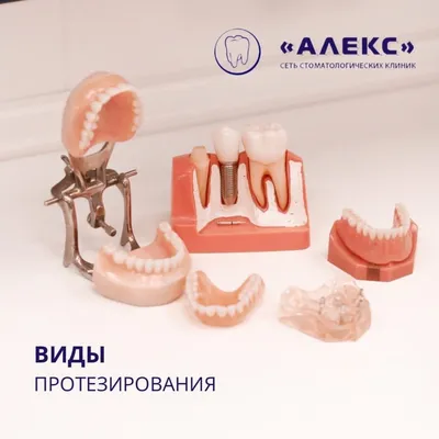 Виды протезирования зубов. Стоматология ТриДента