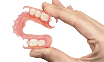 Виды протезирования передних зубов -