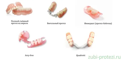 Протезирование зубов: основные виды, подготовка и этапы