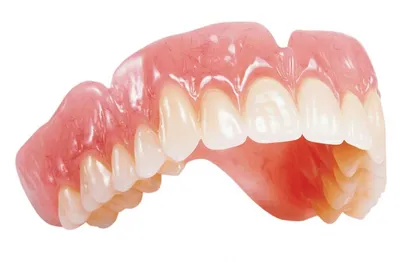 Чем стоматологи заменяют утраченный зуб?