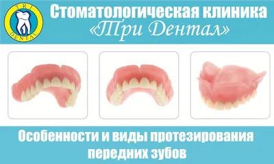 Протезирование зубов: виды зубных протезов и цены в Москве