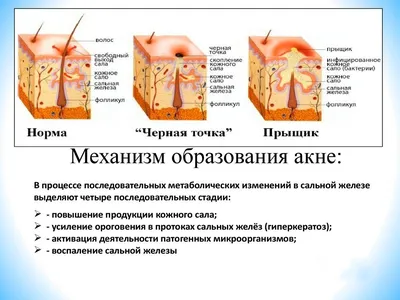 На лице сыпь: причины появления, заболевания и аллергические и угревые  высыпания на коже, лечение