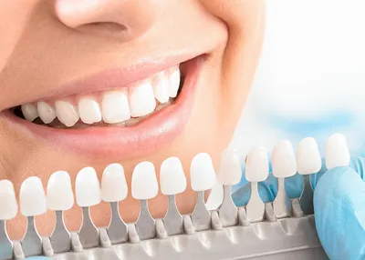 Накладные зубы, силиконовые верхние и нижние виниры, идеальные виниры для  смеха, зубные протезы, поддельные зубные скобы для зубов, инструменты для  гигиены полости рта | AliExpress