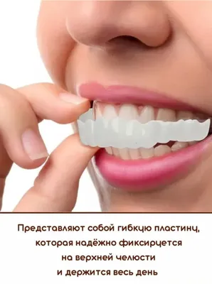 Виниры в Киеве: цена установки зубных виниров в клинике \"Оксфорд Медикал\"