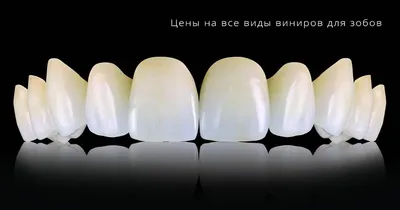 Керамические виниры и люминиры / Тэнь Янь - стоматологическая клиника