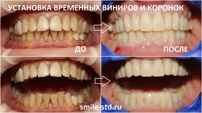 Фото работ до и после в стоматологии \"А-2\"