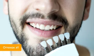Энциклопедия цвета: какого оттенка должны быть зубы, и что об этом нужно  знать?