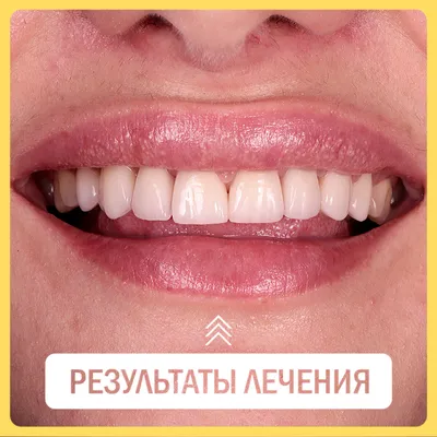 Холистический стоматолог С.С. Барышенский (@doctor_bar) • Instagram photos  and videos