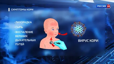 Особо опасные вирусы кори проникли в Казахстан