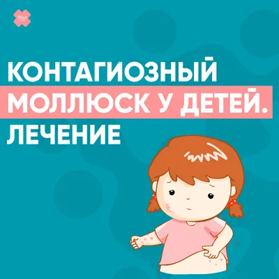 Контагиозный моллюск у детей — причины, симптомы, диагностика и виды  заболевания