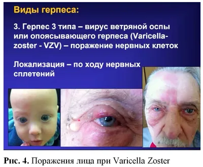Лечение заболевания кожи лица, головы, рук у взрослых и детей в Новосибирске