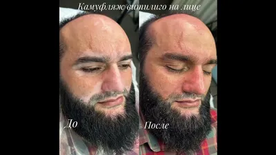 Saatov Vitiligo Clinic / Медицинская клиника Витилиго | Tashkent