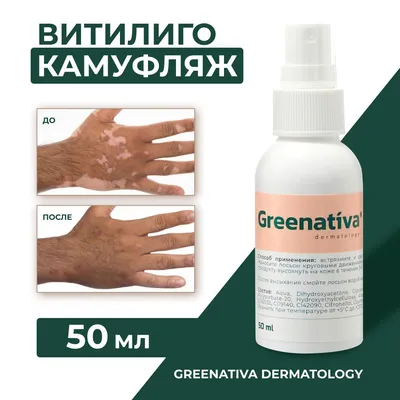 Vitiligo, консилер для белой кожи, водостойкая ручка для макияжа, стойкое  натуральное жидкое покрытие для лица и тела | AliExpress