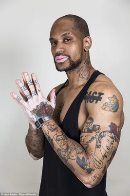 убрали пятна витилиго на лице #vitiligo #shorts - YouTube