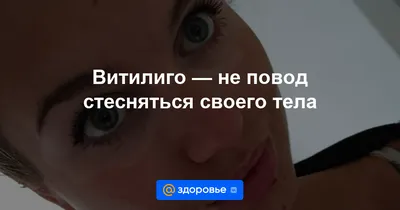 Цвет глаз. Что может рассказать о Вашем здоровье? | Будьте здоровы! | Дзен