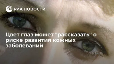 Девушка постоянно стеснялась витилиго, но стоило завести TikTok, как теперь  все любуются её лицом