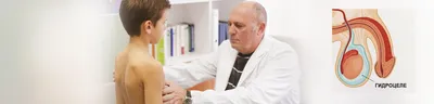 Гидроцеле яичка - операция удаления водянки у мужчин: как проводится  гидроцелэктомия