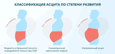 Как снять отек ног народными средствами: список методов