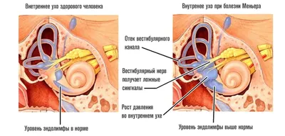 Отек ног у пожилых: причины и лечение - Пансионат Близкие Родственники