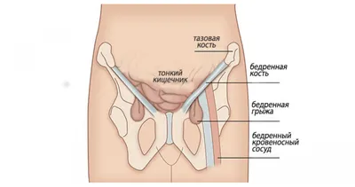 Виды, причины возникновения и способы борьбы с отеками: что такое отек  легких, причины отечности организма