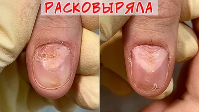 О чем говорят волнистые ногти? | Авторадио - Санкт-Петербург | Дзен