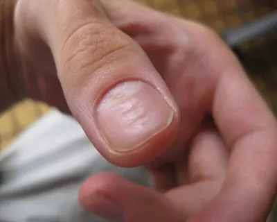 Как скрыть волнистые ногти?