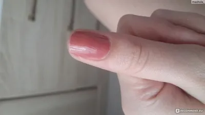 Волнистые ногти у ребенка (58 фото)