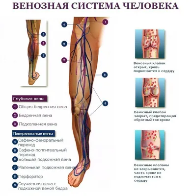 Тромбофлебит поверхностных вен нижних конечностей - презентация онлайн