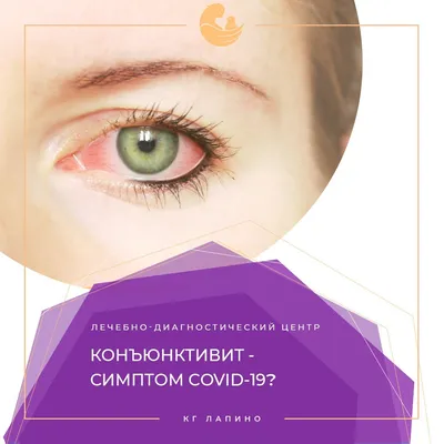 Mari Pharm - 👁Вирусный конъюнктивит- воспаление слизистой оболочки глаза  (конъюнктивы), вызванное аллергией, бактериями, вирусами, грибами и другими  патогенными факторами. ⠀ 😰Вирусный конъюнктивит вызывает сильный  дискомфорт и является опасным для ...