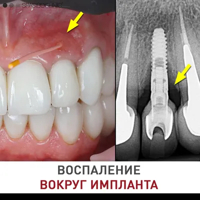 Лечение зубов под микроскопом в стоматологии, цена от 3000 ₽ в СПБ (Пушкин)