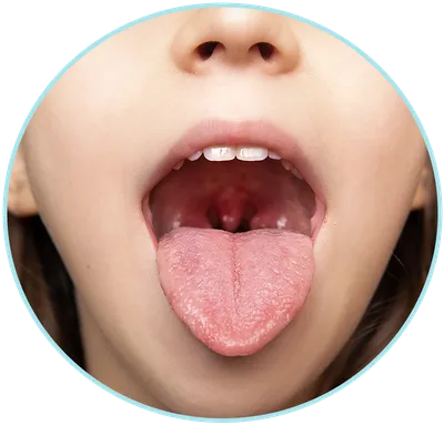 Болит под языком: Что бы это значило? | Здоровье для всех | Дзен