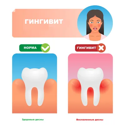 Фармадонт I - пластины для десен при воспалениях полости рта (24 шт.) |  Купить стоматологические товары недорого в интернет-магазине Dental First