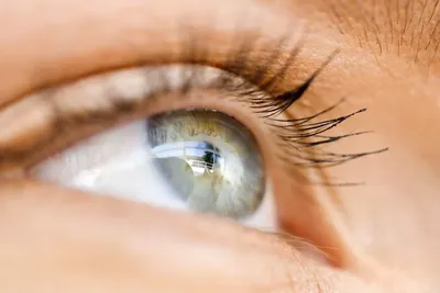 Бельмо на глазу - причины появления, при каких заболеваниях возникает,  диагностика и способы лечения
