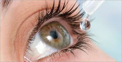 Воспаление роговицы глаза - Amel Vision