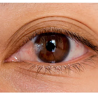 Травмы глаз: какие бывают, способы лечения - ASTANA VISION в г. Астана.
