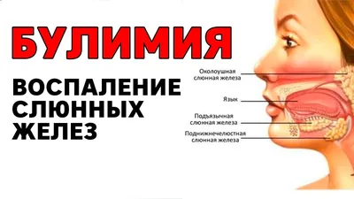 Девочка Н. 5лет, воспаление впервые появилось 6месяцев назад.Пальпация  безболезнена.Со слов матери:увеличивается в размере... | ВКонтакте