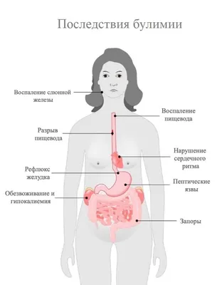 Тонзиллит: причины, симптомы и лечение всех видов заболеваний в ФНКЦ ФМБА