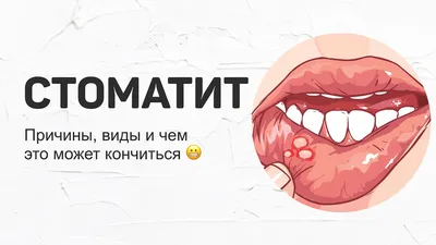 Мукоцеле у собак и кошек | ВКонтакте