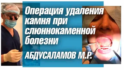 Вы знали, отчего возникает воспаление слюнных желез - сиаладенит? |  Стоматологическая клиника Naudent | Дзен