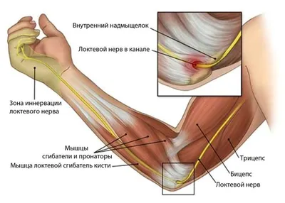 Синдром карпального канала - Medicīnas centrs ARS; +371 67201007