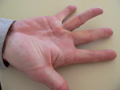 Сухожилия большого пальца | Массаж.ру