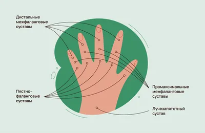 Болит запястье, когда шевелю большим пальцем: причины, методы лечения |  медицинские товары и медтехника в магазине Ортосалон